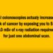 Beware of Colon Cancer Scare: For Many, the Screening Is Riskier Than the Cancer Itself