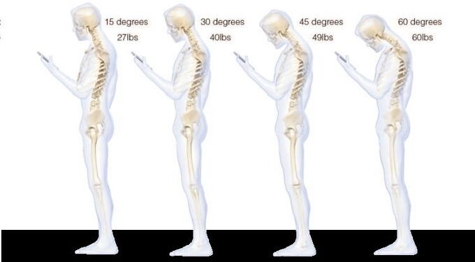 Surgeon Reveals Why Texting Causes So Much Neck Stress