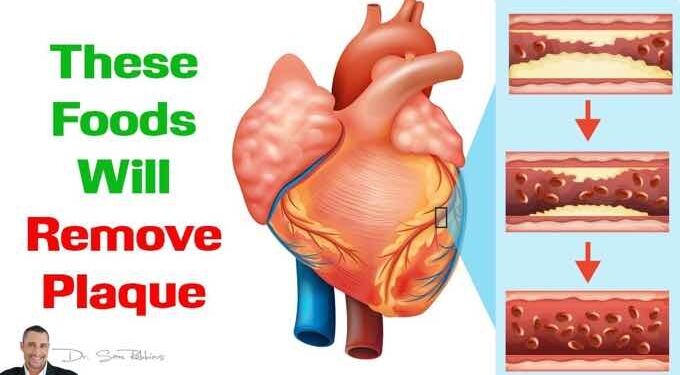 WATCH: These 10 Foods Will Remove Plaque From Your Arteries and Improve Circulation