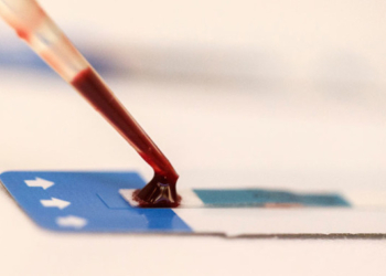 HIV Discovery: Researchers Find Antibody That Neutralizes 98% Of Strains