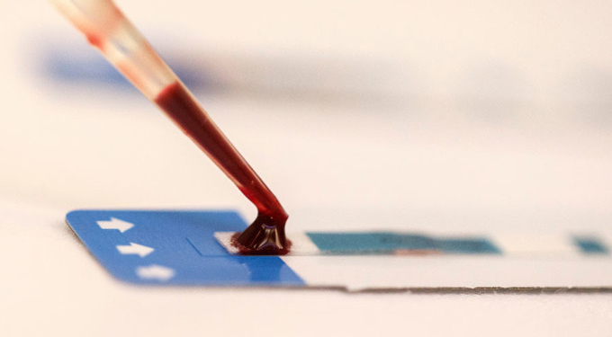 HIV Discovery: Researchers Find Antibody That Neutralizes 98% Of Strains