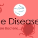 Lyme Disease: What They’re Not Telling You