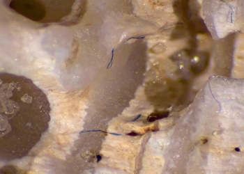 Toxic Clothing: 15 Ways To Stop Global Microfiber Pollution