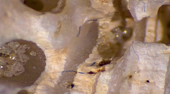 Toxic Clothing: 15 Ways To Stop Global Microfiber Pollution