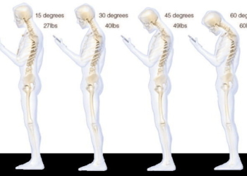 Surgeon Reveals Why Texting Causes So Much Neck Stress