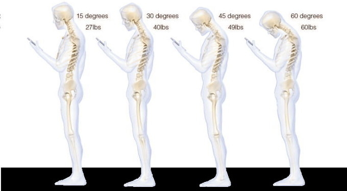 Surgeon Reveals Why Texting Causes So Much Neck Stress