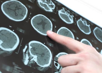 A Radically New Understanding of Alzheimer’s Disease Causes and Cures