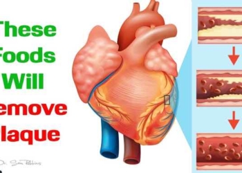 WATCH: These 10 Foods Will Remove Plaque From Your Arteries and Improve Circulation