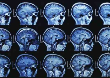 Read the Shocking Conclusions from 28 Medical Studies Linking Fluoride to Lower IQ in Children