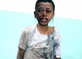 With US Bombs Killing Kids in Yemen, Sanders Tells Pompeo ‘Human Lives Worth Far More Than Defense Contractor Profits’