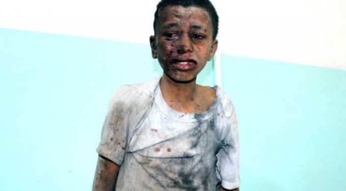 With US Bombs Killing Kids in Yemen, Sanders Tells Pompeo ‘Human Lives Worth Far More Than Defense Contractor Profits’