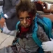 US-Backed War Risks Killing an ‘Entire Generation’ of Yemeni Children