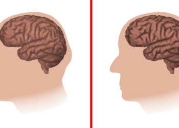 5 Things That Make Your Brain Age Faster, According to Science