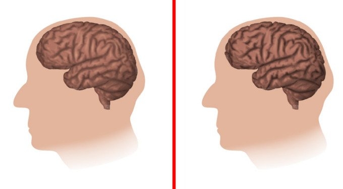 5 Things That Make Your Brain Age Faster, According to Science