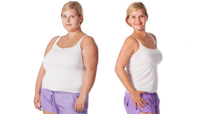 Bariatric Surgery and How It Plays a Key Role In Combating Obesity