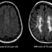 Scientists May Have Just Found a Way to Prevent the Brain From Aging