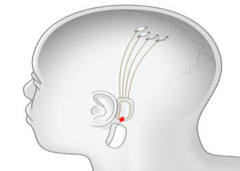 Elon Musk’s Neuralink Looks to Begin Outfitting Human Brains With Faster Input and Output Starting Next Year