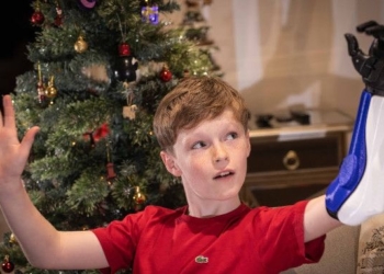 WATCH: 10 Years Old Jacob Pickering Gets 3D-printed ‘Hero Arm’ for Christmas