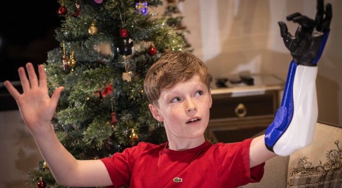 WATCH: 10 Years Old Jacob Pickering Gets 3D-printed ‘Hero Arm’ for Christmas