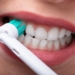 What’s the Best Way to Take Care of Your Teeth?