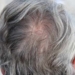Scientists Finally Figure Out How Stress Turns Hair Gray