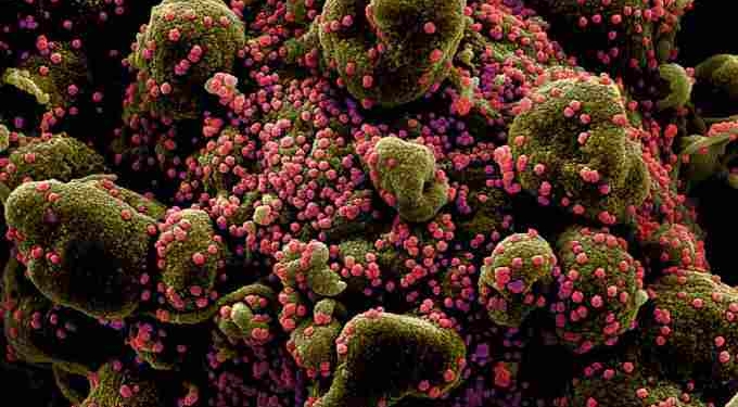 This Is What The Coronavirus Does To Your Body That Makes It So Deadly