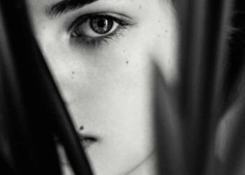 Must-Read Tips If You’re Planning To Remove Your Mole on Your Own
