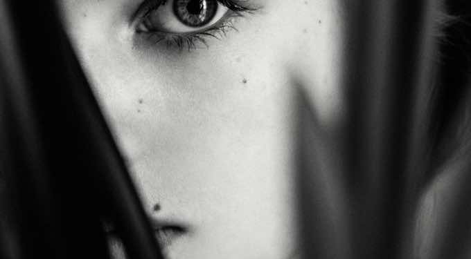 Must-Read Tips If You’re Planning To Remove Your Mole on Your Own