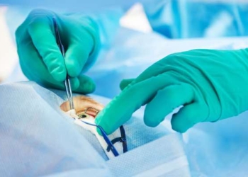 Optometrists Debate Pros & Cons of LASIK Surgery