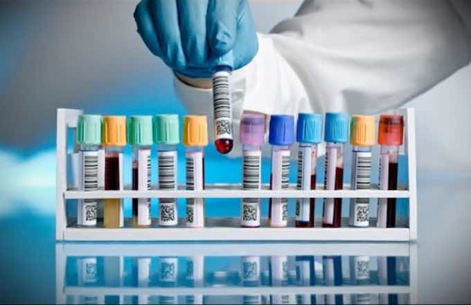 Required to Pass a Drug Test? Here Is How to Do It