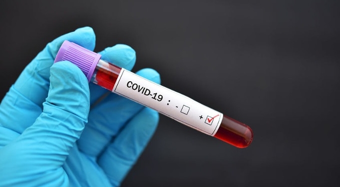 Are Public Health Decisions Based on Inaccurate COVID Tests?