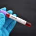 Are Public Health Decisions Based on Inaccurate COVID Tests?