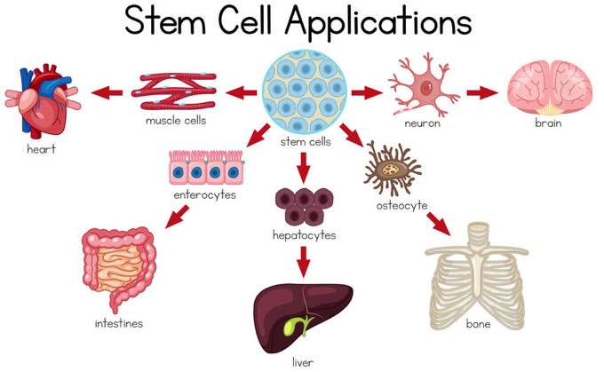 4 Important Questions You Need to Ask a Stem Cell Clinic