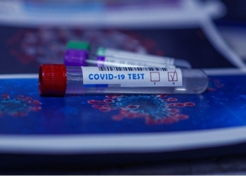 A Global Team of Experts Has Found 10 FATAL FLAWS in the Main Test for COVID-19 and is Demanding It’s Urgently Axed