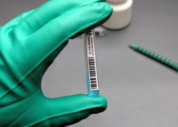 Shocking Report on COVID Vaccine Adverse Effects: The Roll-Out Continues Anyway