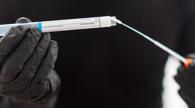 Why COVID-19 Cases Will Instantly Drop